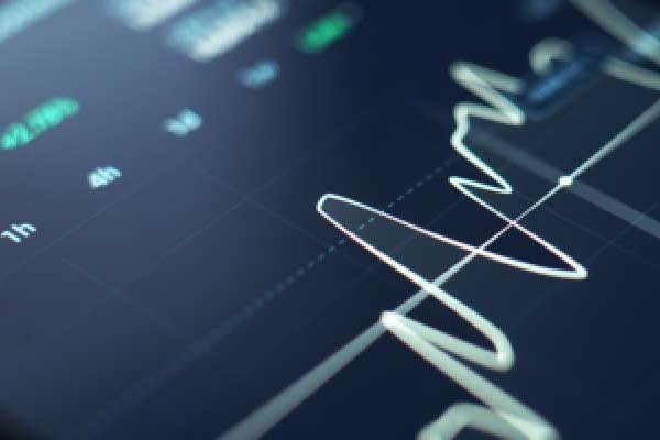 据报道 英特尔将裁员20%以上